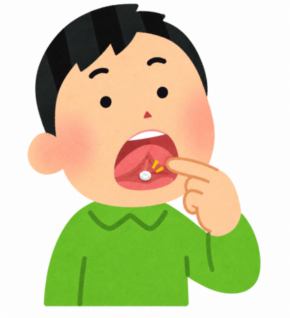 舌下免疫療法（シダキュア）